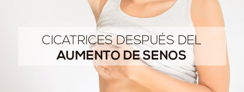 Cicatrices después del aumento de senos Cicatrices después del aumento de senos