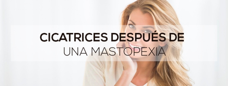 Cicatrices después de una mastopexia Cicatrices después de una mastopexia