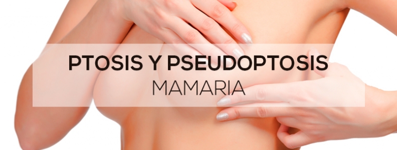 Ptosis y pseudoptosis mamaria Ptosis y pseudoptosis mamaria
